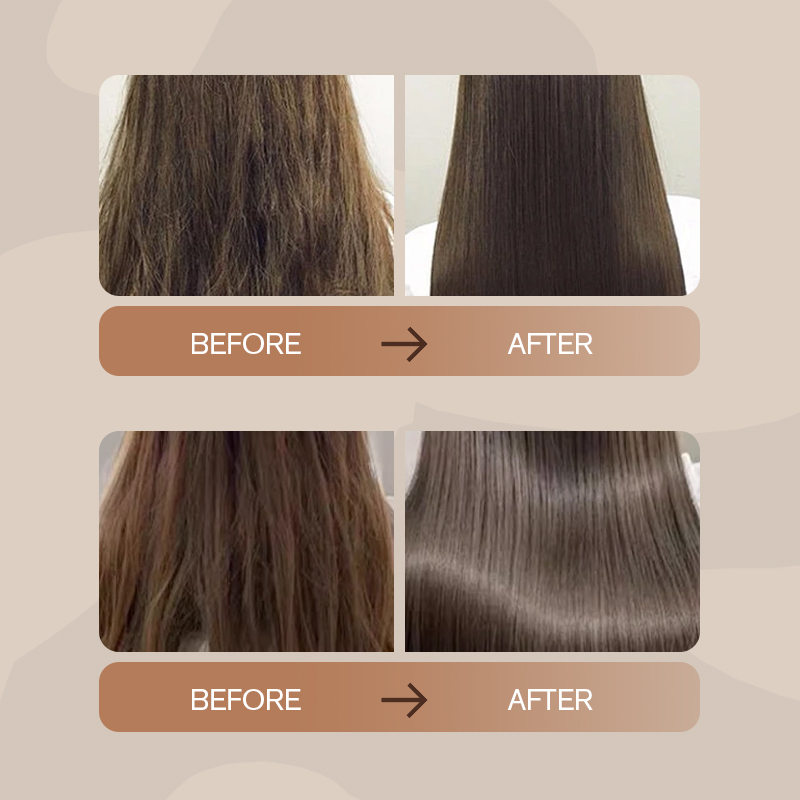 LEADERHAIR Organic Anti-Dandruff Refreshing Shampoo With Natural Plant Ingredients