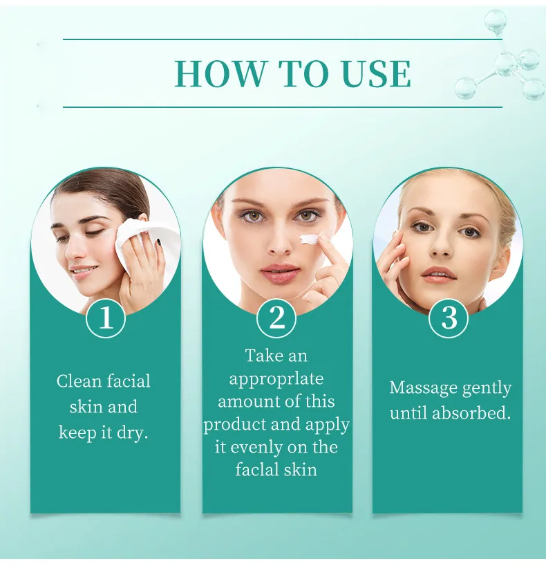 Acne Face Cream 30g Hydrating Anti-Acne Treatment Cream for Blemish Care & Oil Control