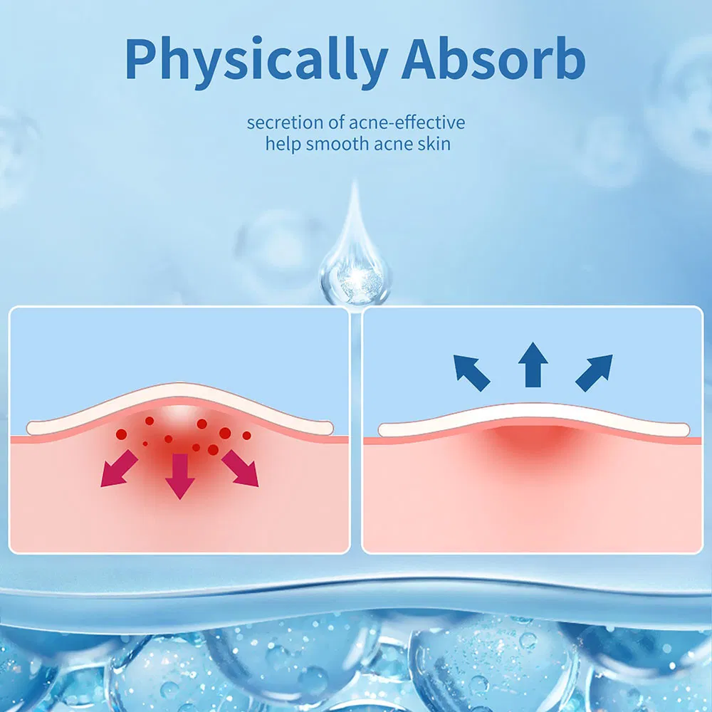 Customized Acne Pimple Treatment with Mirror Hydrocolloid Deep Skin Care Best Sell