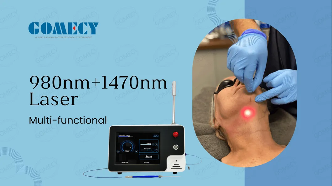 Endolifting Diode Laser