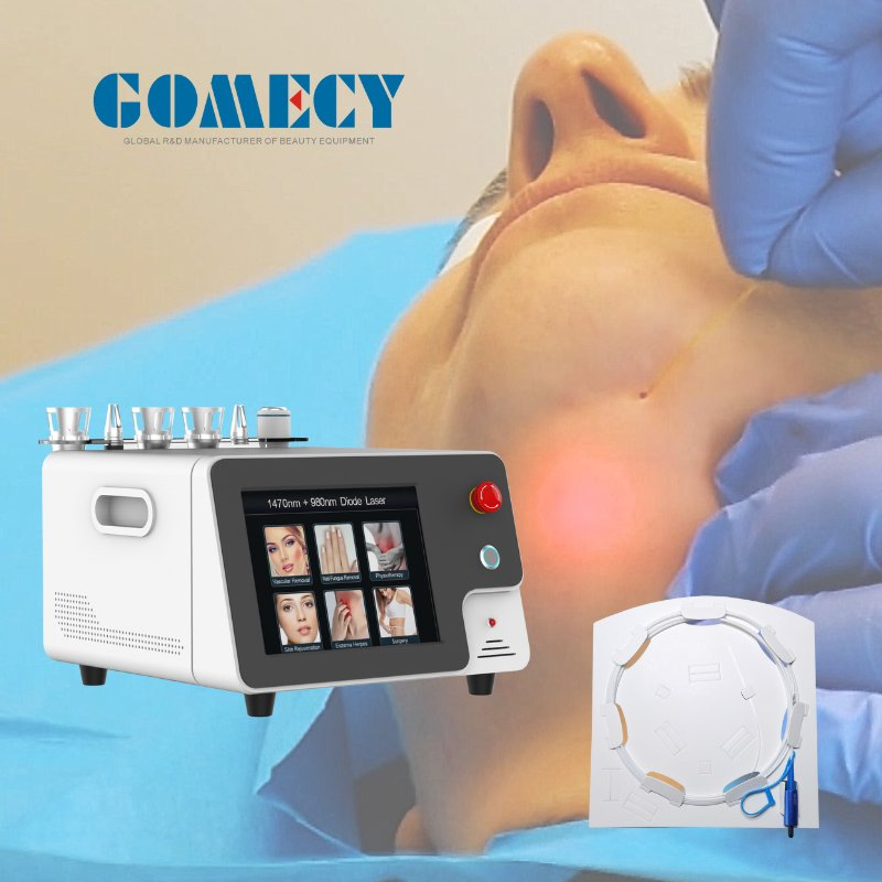 Gomecy Laser Liposuction Machine 1470nm Endolifting Diode Laser Face Lifting