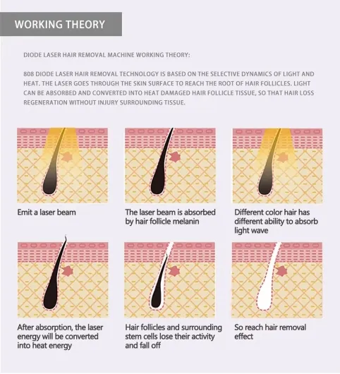 Diode Laser Machine 3