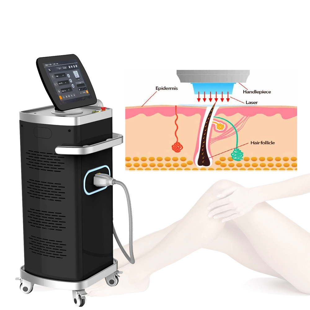 Advanced 808nm Diode Laser Hair Removal Machine for Solon