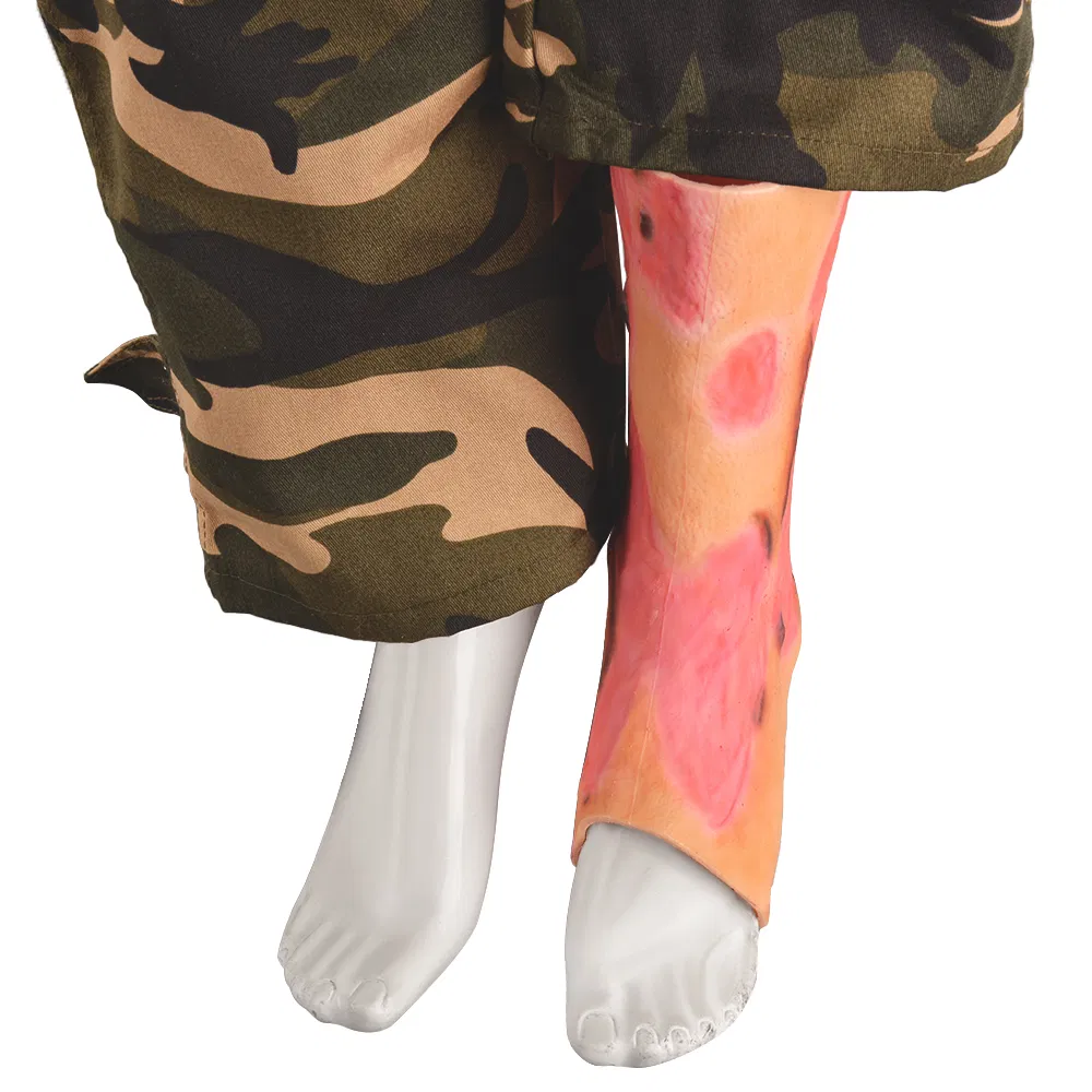 Meia de silicone para queima no tornozelo (meia grande)