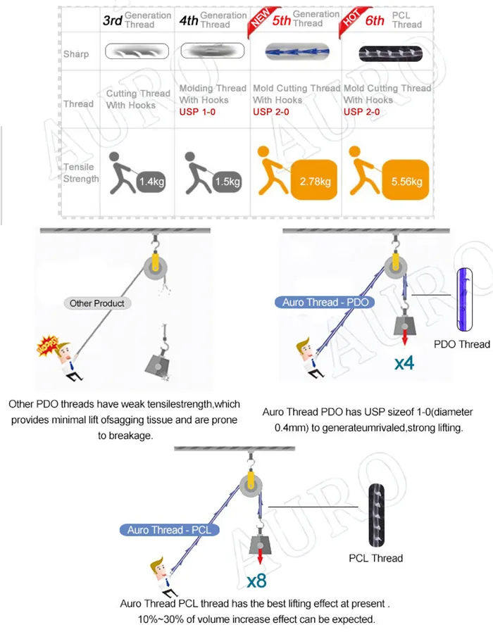 Screw and Cog Thread comparison