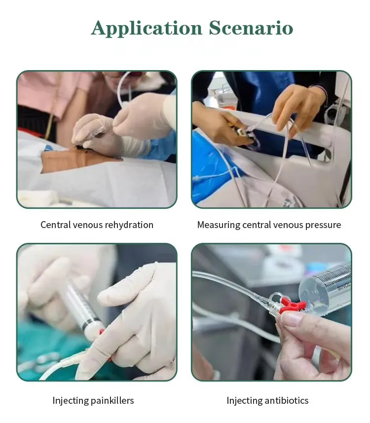 OEM Disposable Catheter