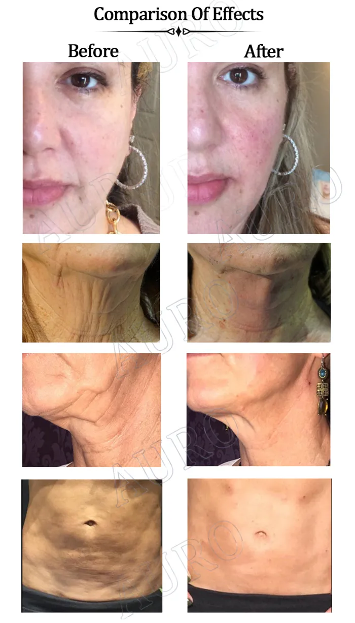 Customized Thread Sizes