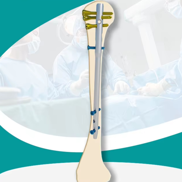 Professional Titanium Alloy Multi-Dimensional Locking Intramedullary Nail Combination Implant Set for Humeral Tibia CE Certified